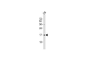 Anti-UBE2N Antibody (Center) at 1:500 dilution + C6 whole cell lysates Lysates/proteins at 20 μg per lane. (UBE2N antibody  (AA 41-74))