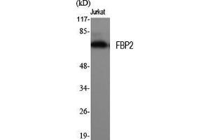 Western Blot (WB) analysis of specific cells using FBP2 Polyclonal Antibody.