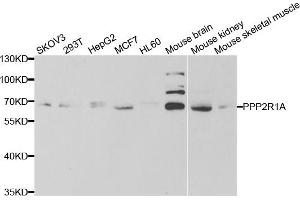 Western blot analysis of extracts of various cell lines, using PPP2R1A antibody. (PPP2R1A antibody)