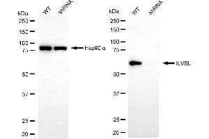 Western blotting analysis using ILVBL antibody (ABIN7799022). (ILVBL antibody)