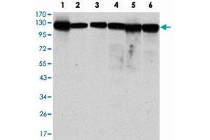 Western blot analysis using MCM2 monoclonal antibody, clone 1E7  against MCF-7 (1), HeLa (2), Jurkat (3), K-562 (4), HEK293 (5) and HEPG2 (6) cell lysate.