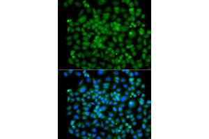 Immunofluorescence analysis of A549 cell using PSMB8 antibody. (PSMB8 antibody)