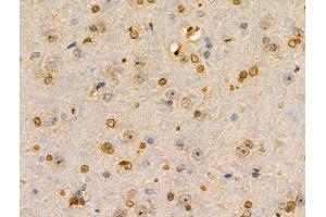 ABIN6259152 and ABIN6274301 at 1/100 staining Rat brain tissue by IHC-P. (PITX1 antibody  (Internal Region))