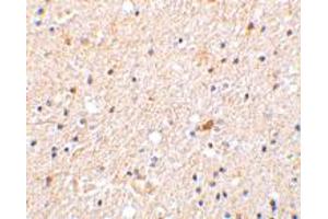 Immunohistochemistry of NGFRAP1 in human brain tissue with NGFRAP1 polyclonal antibody  at 2 ug/mL . (Nerve Growth Factor Receptor (TNFRSF16) Associated Protein 1 (NGFRAP1) (Internal Region) antibody)
