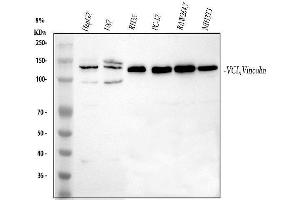 Western blot analysis of Vinculin using anti-Vinculin antibody (ABIN5518889).
