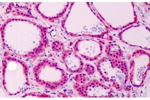 Human Thyroid: Formalin-Fixed, Paraffin-Embedded (FFPE) (Calmodulin 1 antibody  (C-Term))