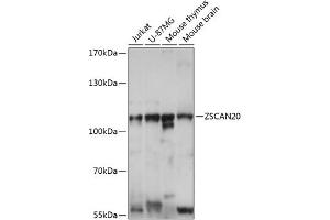 Western blot analysis of extracts of various cell lines, using ZSC antibody (ABIN7271443) at 1:1000 dilution. (ZSCAN20 antibody  (AA 1-200))