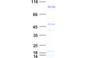 Validation with Western Blot
