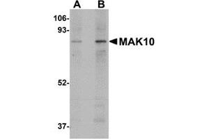 Western Blotting (WB) image for anti-MAK10 Homolog, Amino-Acid N-Acetyltransferase Subunit (MAK10) (Middle Region) antibody (ABIN1030993)