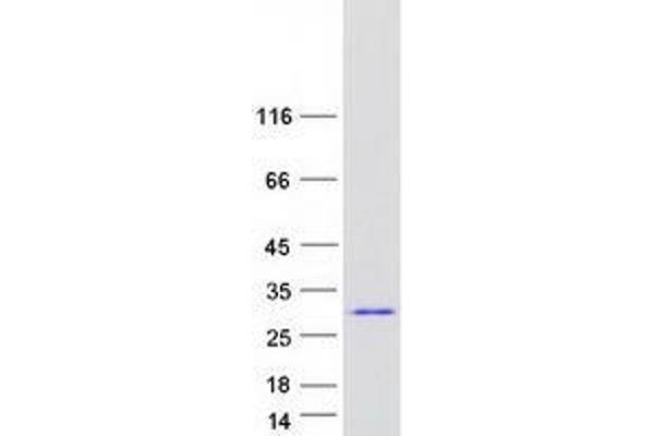 Zinc Finger and SCAN Domain Containing 31 (ZSCAN31) (Transcript Variant 1) protein (Myc-DYKDDDDK Tag)