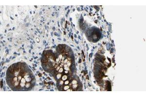 ABIN6269192 at 1/100 staining Mouse intestine tissue by IHC-P. (CBL antibody  (Internal Region))