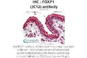Image no. 1 for anti-Forkhead Box P1 (FOXP1) antibody (ABIN5693578) (FOXP1 antibody)