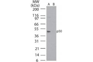 Image no. 1 for anti-Nuclear Factor of kappa Light Polypeptide Gene Enhancer in B-Cells 1 (NFKB1) (AA 150-200) antibody (ABIN200016) (NFKB1 antibody  (AA 150-200))
