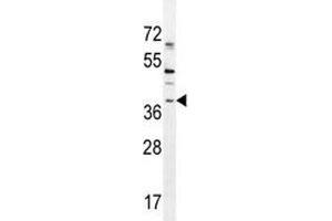 SOX1 antibody western blot analysis in NCI-H460 lysate. (SOX1 antibody  (AA 47-76))