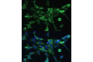 Immunofluorescence analysis of NIH-3T3 cells using COX6 Polyclonal Antibody (ABIN6132108, ABIN6138915, ABIN6138916 and ABIN6220368) at dilution of 1:100 (40x lens). (COX6A1 antibody  (AA 25-109))