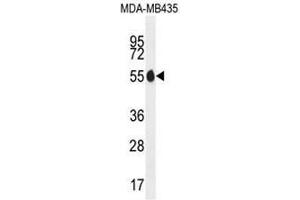 PAX1 Antibody (N-term) western blot analysis in MDA-MB435 cell line lysates (35µg/lane). (PAX1 antibody  (N-Term))