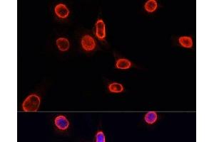 Immunofluorescence analysis of NIH/3T3 cells using MonoMethyl-Histone H3-K9 Polyclonal Antibody at dilution of 1:100.