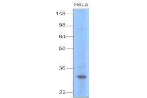 Cell lysates of HeLa (30 ug) were resolved by SDS-PAGE, transferred to PVDF membrane and probed with anti-human UNG (1:1000). (UNG antibody  (AA 1-313))