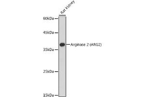 Western blot analysis of extracts of Rat kidney, using Arginase 2  antibody (ABIN6131236, ABIN6137078, ABIN6137079 and ABIN6221969) at 1:1000 dilution. (ARG2 antibody  (AA 1-354))