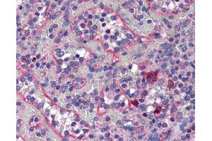 Anti-COPB2 antibody IHC of human spleen. (COPB2 antibody  (AA 494-511))