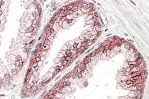 ABIN185626 (3. (CTNNA1 antibody  (Internal Region))
