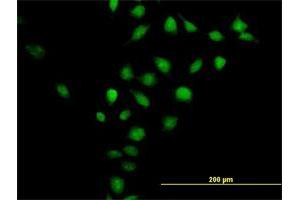 Immunofluorescence of purified MaxPab antibody to CNNM3 on HeLa cell. (Cyclin M3 antibody  (AA 1-355))