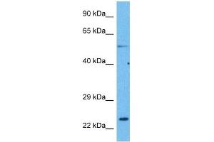 Host:  Rabbit  Target Name:  CACNG1  Sample Tissue:  Human Lung Tumor  Antibody Dilution:  1ug/ml (CACNG1 antibody  (N-Term))