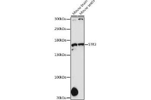 Western blot analysis of extracts of various cell lines, using STK36 antibody (ABIN6135016, ABIN6148614, ABIN6148615 and ABIN7101365) at 1:1000 dilution. (STK36 antibody  (AA 250-450))