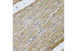 Immunohistochemistry of paraffin-embedded rat heart using CDH16 antibody. (Cadherin-16 antibody  (AA 19-230))