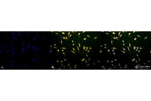 Immunocytochemistry/Immunofluorescence analysis using Rabbit Anti-Rab5 Polyclonal Antibody . (RAB5 antibody  (Atto 594))