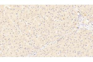 Detection of LRP5 in Human Liver Tissue using Polyclonal Antibody to Low Density Lipoprotein Receptor Related Protein 5 (LRP5) (LRP5 antibody  (AA 769-1016))