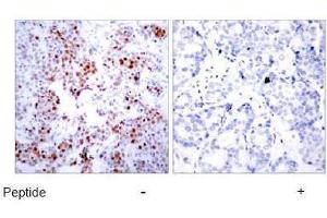 Image no. 1 for anti-Activating Transcription Factor 2 (ATF2) (Ser44), (Ser62) antibody (ABIN197144) (ATF2 antibody  (Ser44, Ser62))