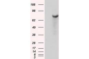 Image no. 4 for anti-Bruton Agammaglobulinemia tyrosine Kinase (BTK) antibody (ABIN1496972) (BTK antibody)