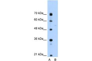 WB Suggested Anti-SLA Antibody Titration:  0. (SLA antibody  (N-Term))
