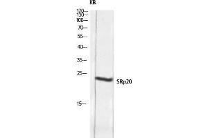 Western Blot (WB) analysis of KB lysis using SRp20 antibody. (SRSF3 antibody  (C-Term))