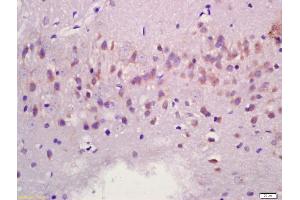 Formalin-fixed and paraffin embedded rat brain labeled with Anti-MAPK11 Polyclonal Antibody, Unconjugated (ABIN754393) at 1:200 followed by conjugation to the secondary antibody and DAB staining