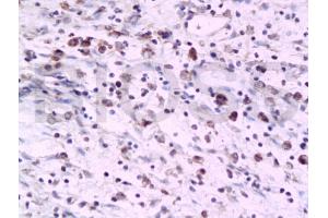 Formalin-fixed and paraffin embedded rat colon tissue labeled with Anti-PTAFR Polyclonal Antibody, Unconjugated (ABIN687127) at 1:200 followed by conjugation to the secondary antibody and DAB staining
