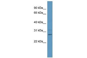 PSPH antibody used at 1 ug/ml to detect target protein. (PSPH antibody  (Middle Region))