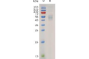 Human IL13 Protein, hFc Tag on SDS-PAGE under reducing condition.