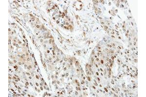 IHC-P Image Immunohistochemical analysis of paraffin-embedded human Trachea, using RanGAP1, antibody at 1:100 dilution. (RANGAP1 antibody  (N-Term))