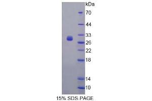 SDS-PAGE (SDS) image for Fibrosin (FBS) (AA 11-247) protein (His tag) (ABIN4989282)