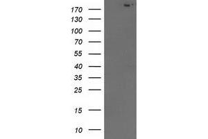 Image no. 1 for anti-SNF2 Histone Linker PHD RING Helicase, E3 Ubiquitin Protein Ligase (SHPRH) (AA 1-100) antibody (ABIN1490555) (SHPRH antibody  (AA 1-100))