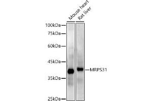 Western blot analysis of extracts of various cell lines, using MRPS31 antibody (ABIN7268585) at 1:1000 dilution. (MRPS31 antibody)