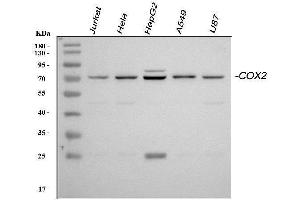 Western blot analysis of PTGS2 using anti-PTGS2 antibody (ABIN5518867).
