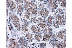 Immunohistochemistry (IHC) image for anti-Bruton Agammaglobulinemia tyrosine Kinase (BTK) antibody (ABIN1496972) (BTK antibody)