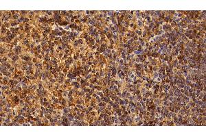 Detection of CD8a in Human Spleen Tissue using Polyclonal Antibody to Cluster Of Differentiation 8a (CD8a) (CD8 alpha antibody  (AA 27-247))