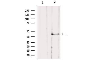 Western blot analysis of extracts from hybridoma cells, using GNA11 Antibody.