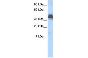 Human Thymus; WB Suggested Anti-ZNF297B Antibody Titration: 0. (ZBTB43 antibody  (Middle Region))