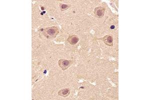 Paraformaldehyde-fixed, paraffin embedded Human brain tissue, Antigen retrieval by boiling in sodium citrate buffer (pH6. (PIN1 antibody)