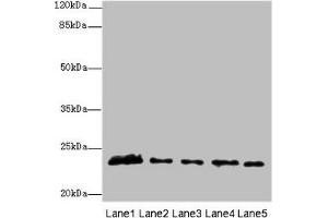 Western blot All lanes: MMD2 antibody at 3 μg/mL Lane 1: Mouse brain tissue Lane 2: Mouse kidney tissue Lane 3: U251 whole cell lysate Lane 4: 293T whole cell lysate Lane 5: Mouse liver tissue Secondary Goat polyclonal to rabbit IgG at 1/10000 dilution Predicted band size: 32, 29, 23 kDa Observed band size: 23 kDa (MMD2 antibody  (AA 1-38))